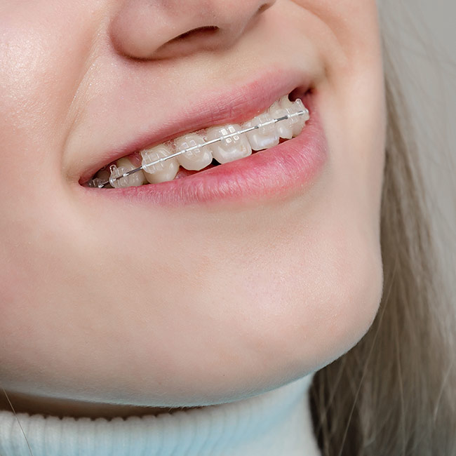 Ortodoncia IGB Dental