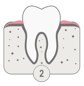 Periodoncia. Imagen fase 2