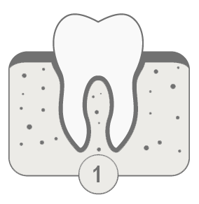 Periodoncia. Imagen fase 1