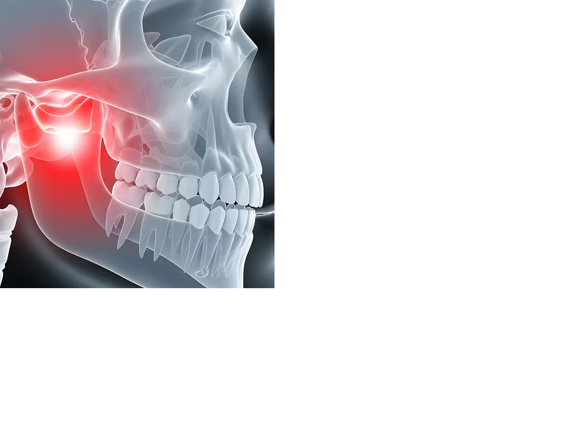Prostodoncia IGB Dental 02
