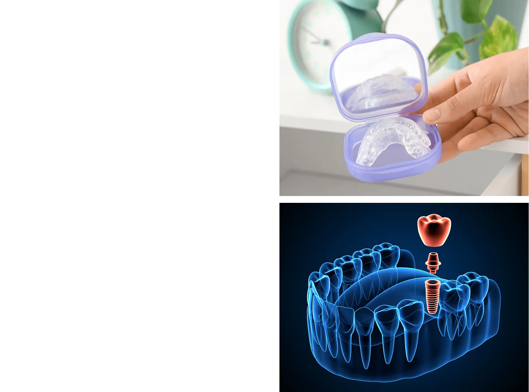 Prostodoncia. IGB Dental