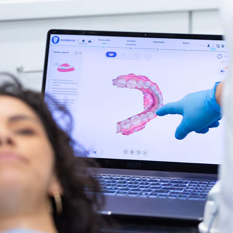 IGB implantes y dientes fijos en un día