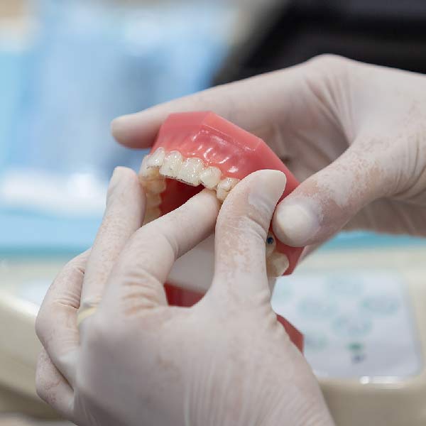 invisalign IGB alicante