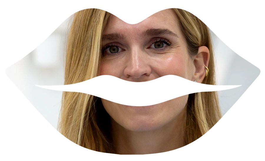 imagen labios ácido hialurónico IGB