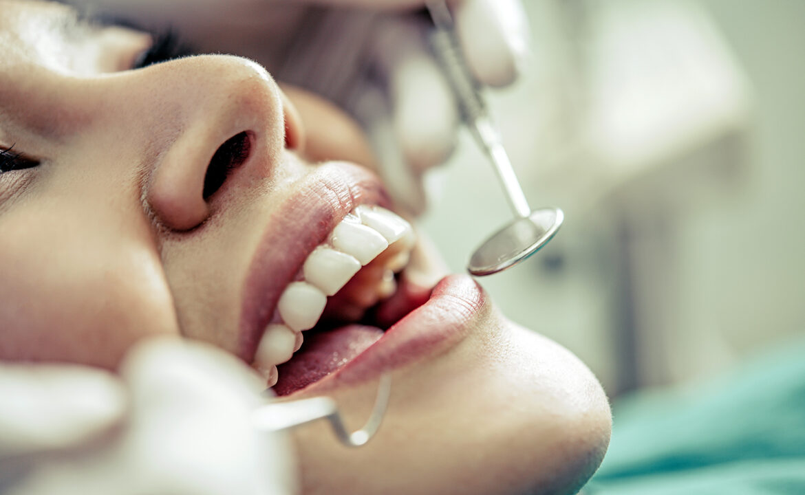 ¿Qué es un curetaje dental?