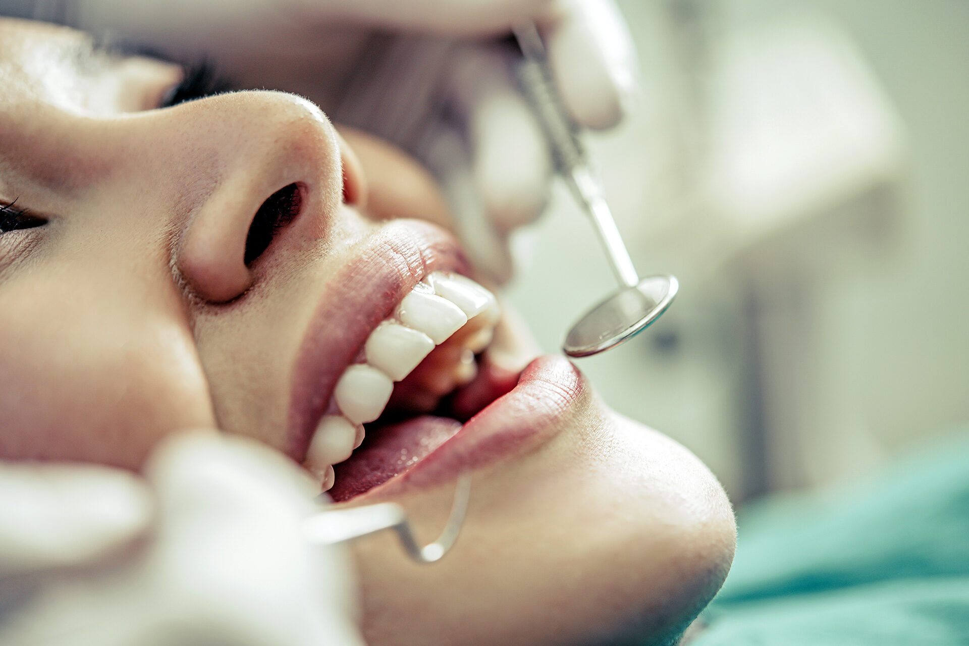 ¿Qué es un curetaje dental?