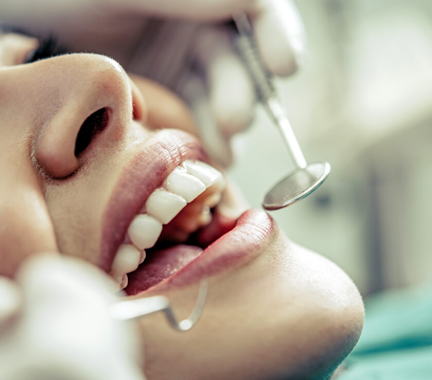 ¿Qué es un curetaje dental?