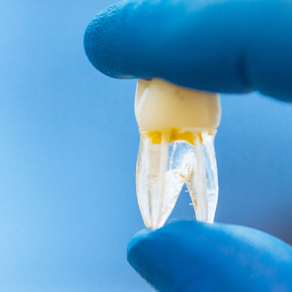 ¿Los dientes son huesos?