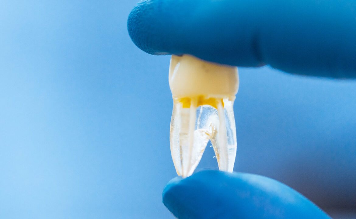 ¿Los dientes son huesos?