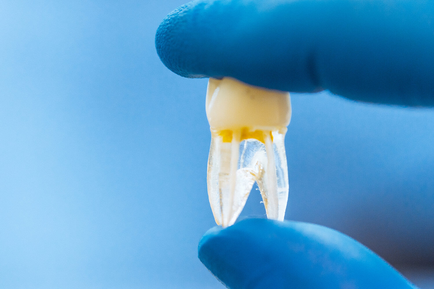 ¿Los dientes son huesos?