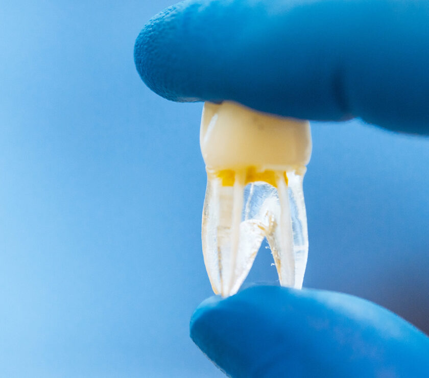 ¿Los dientes son huesos?