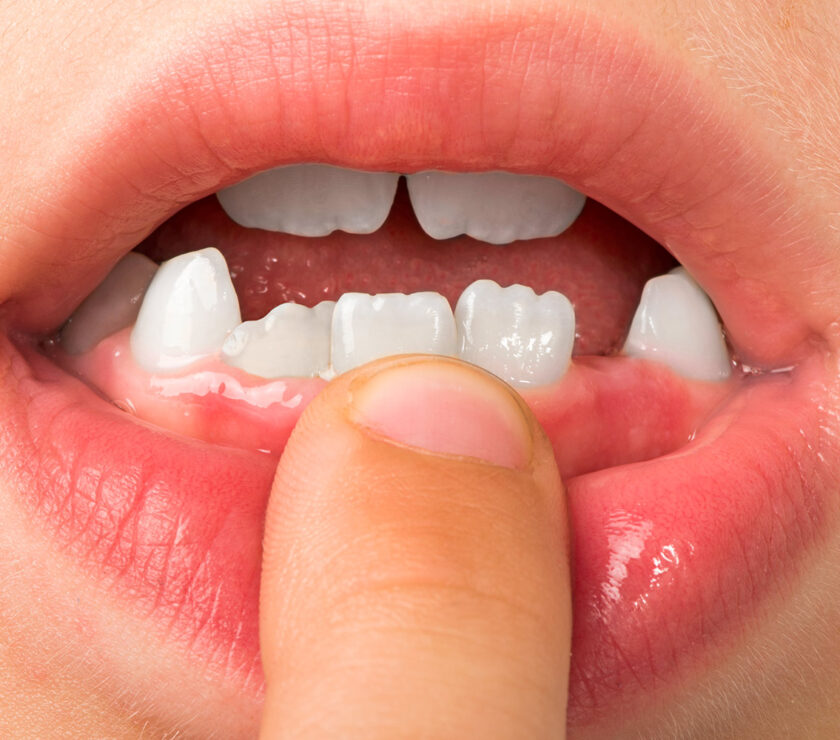 dientes leche