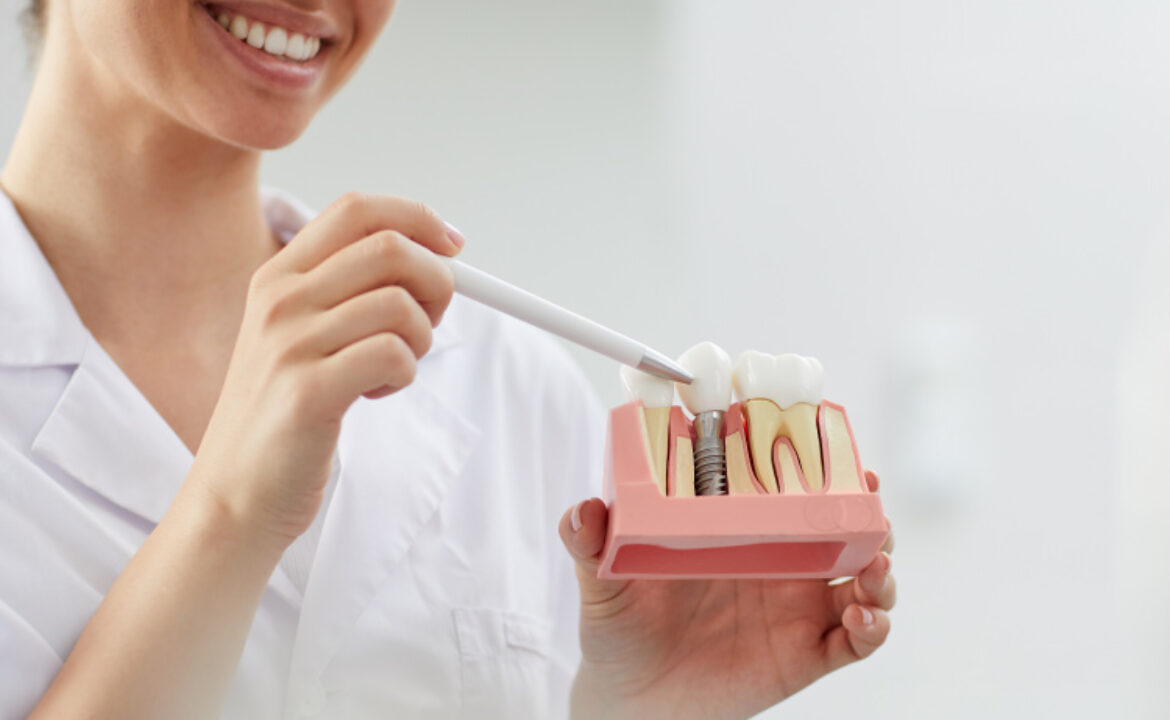 implante dental implantología
