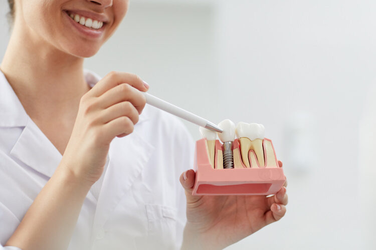 implante dental implantología