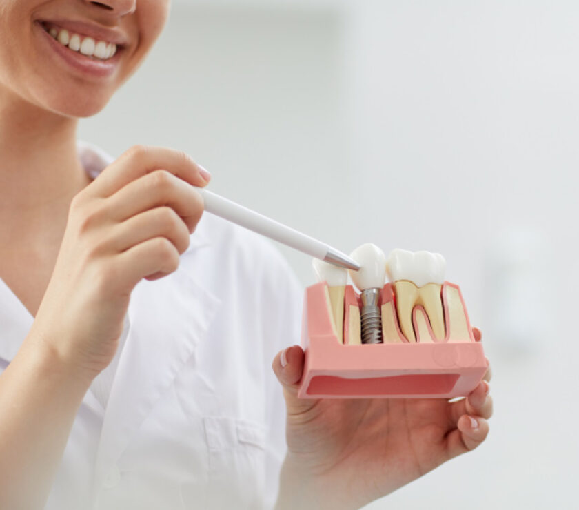 implante dental implantología