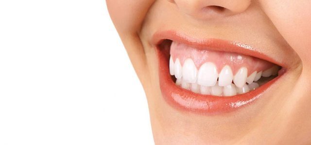Sonrisa gingival.
