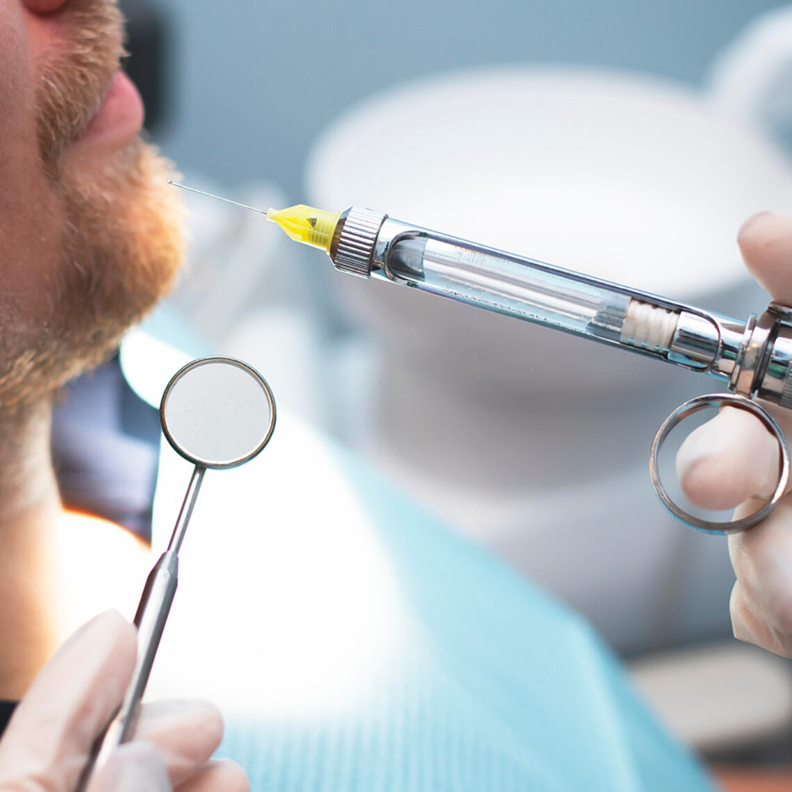 anestesia local en implantes dentales