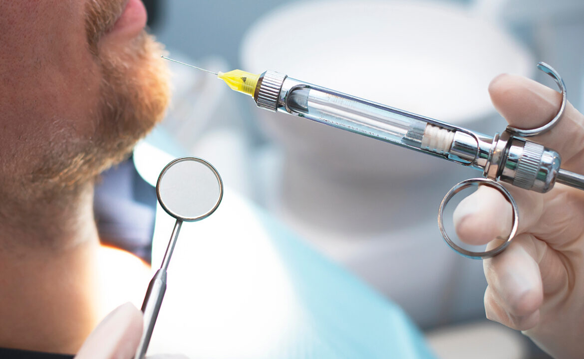 anestesia local en implantes dentales