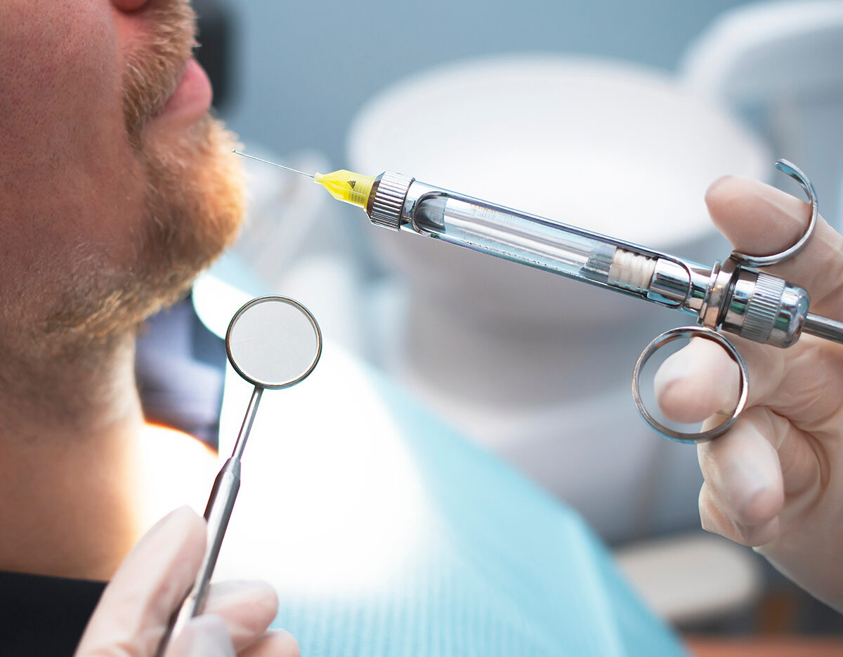 anestesia local en implantes dentales