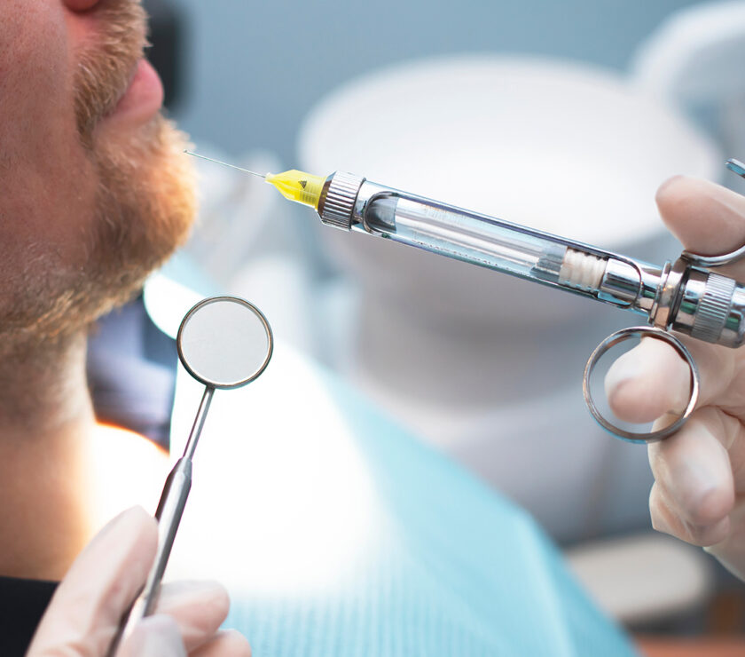 anestesia local en implantes dentales