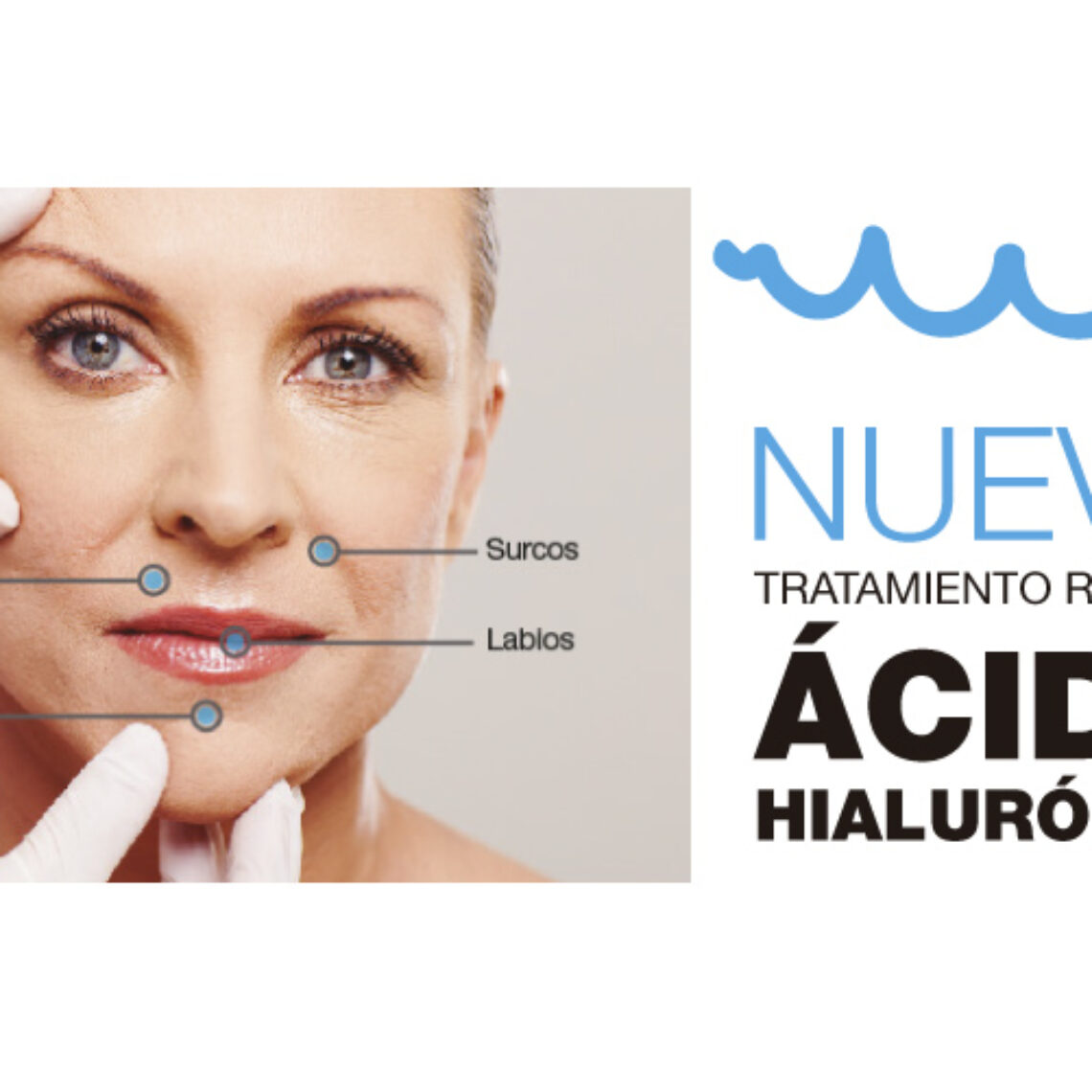 ácido hialurónico