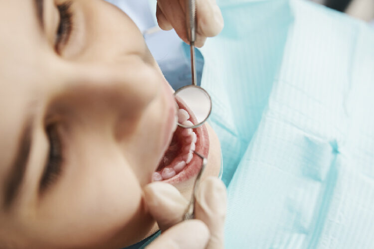 periodontitis