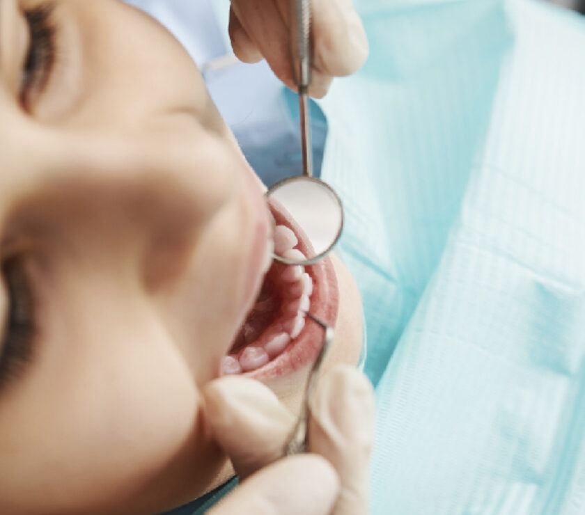 periodontitis