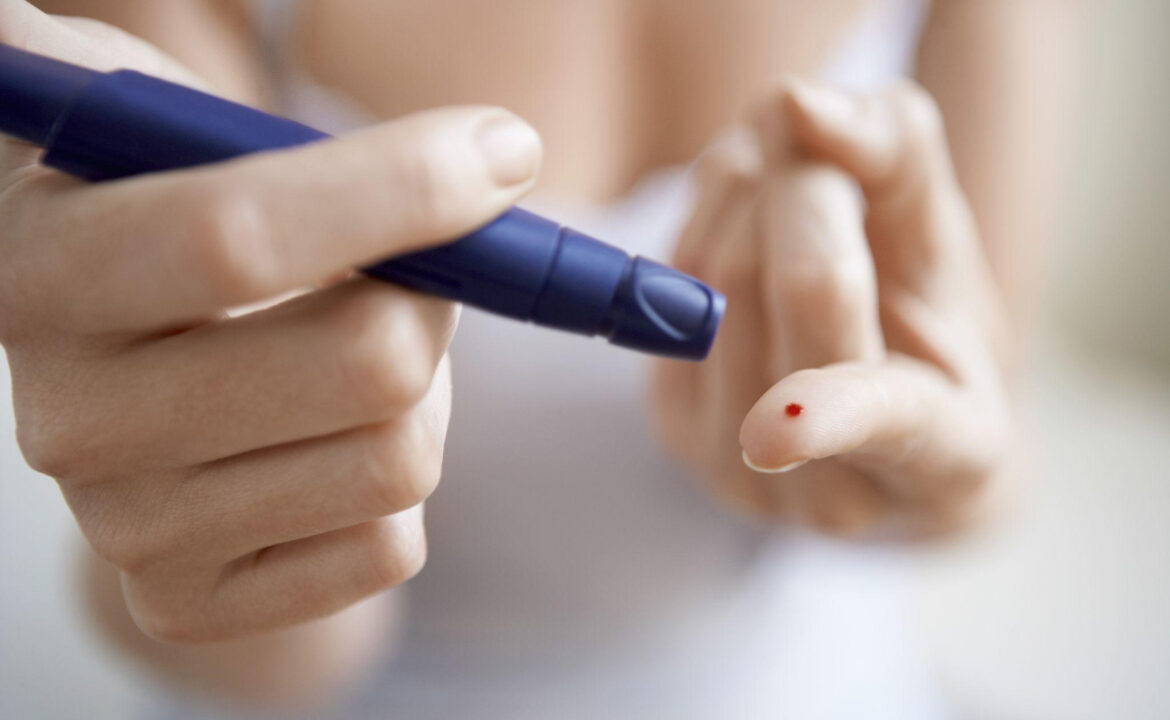 Diabetes y salud bucodental