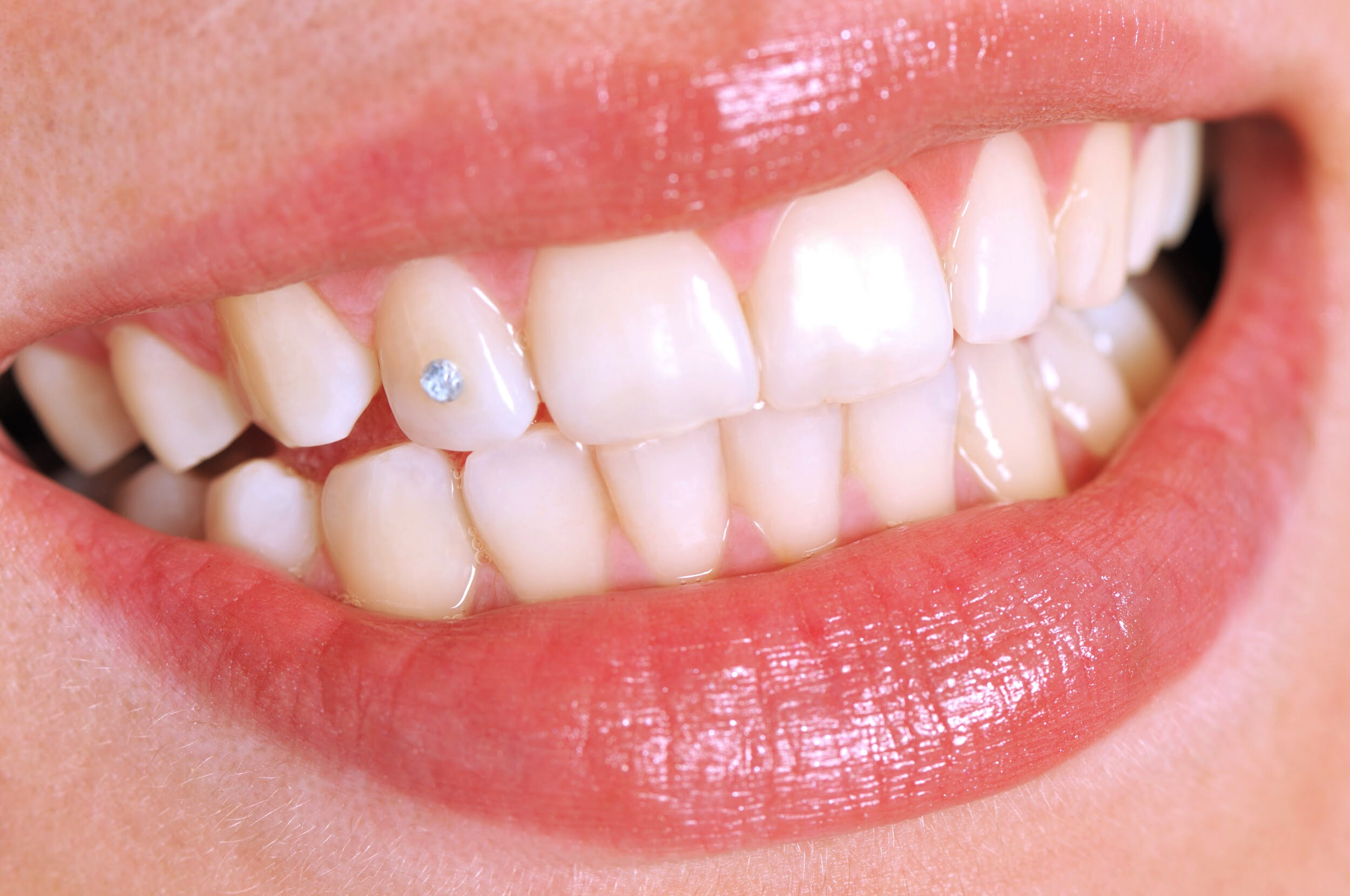 Grillz dental y joyas dentales