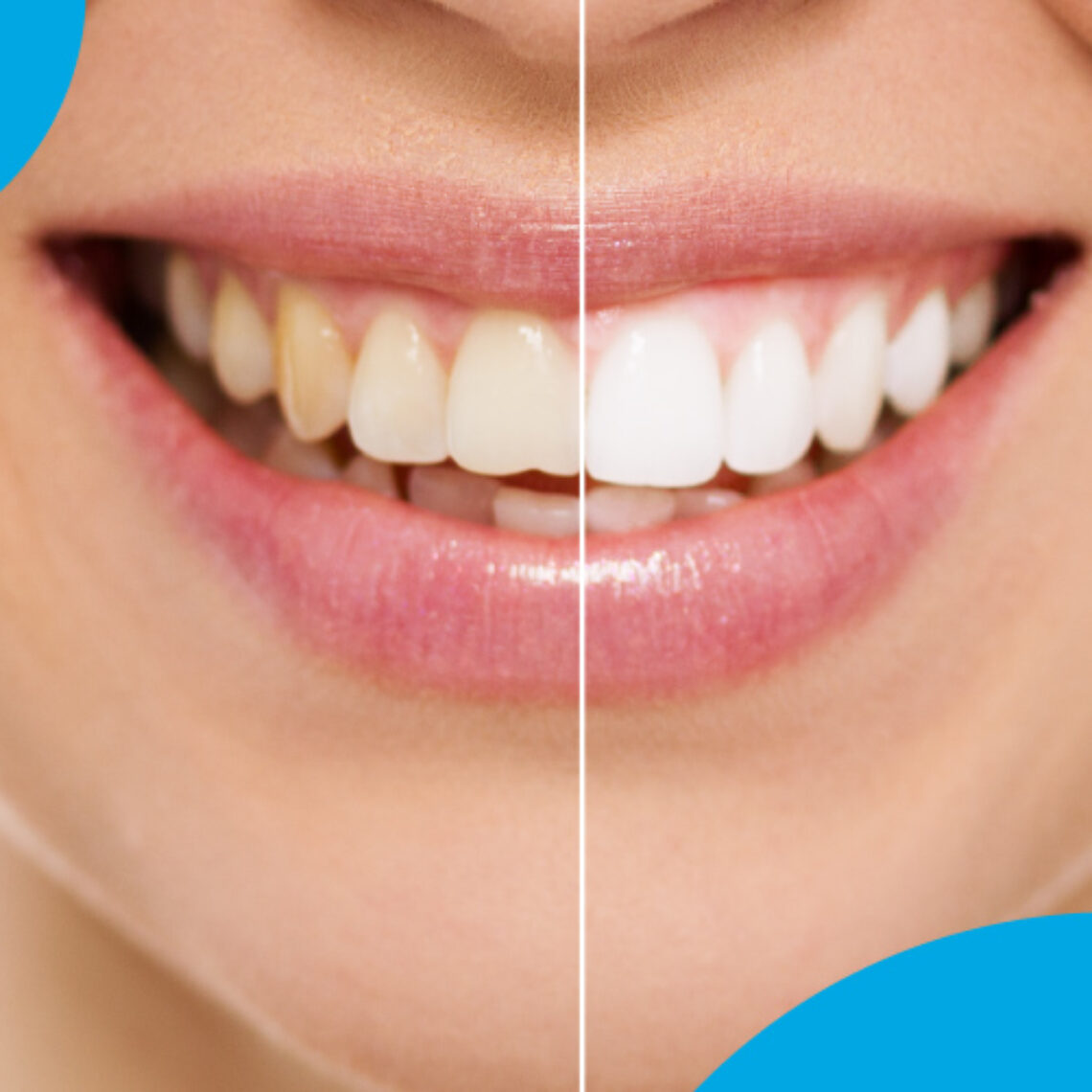 color dientes