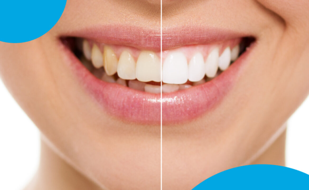 color dientes