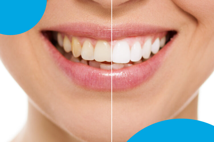 color dientes